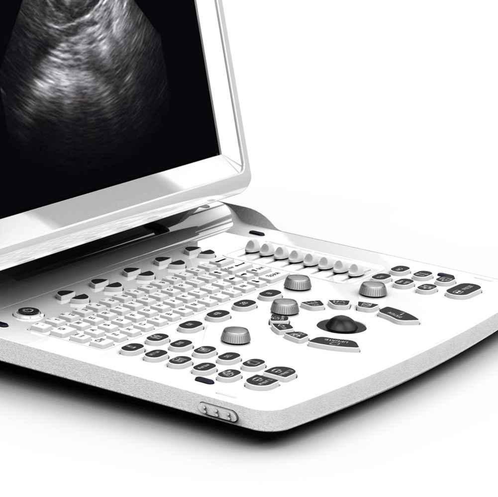 CHISON ECO3 EXPERT Veterinary Ultrasound Machine