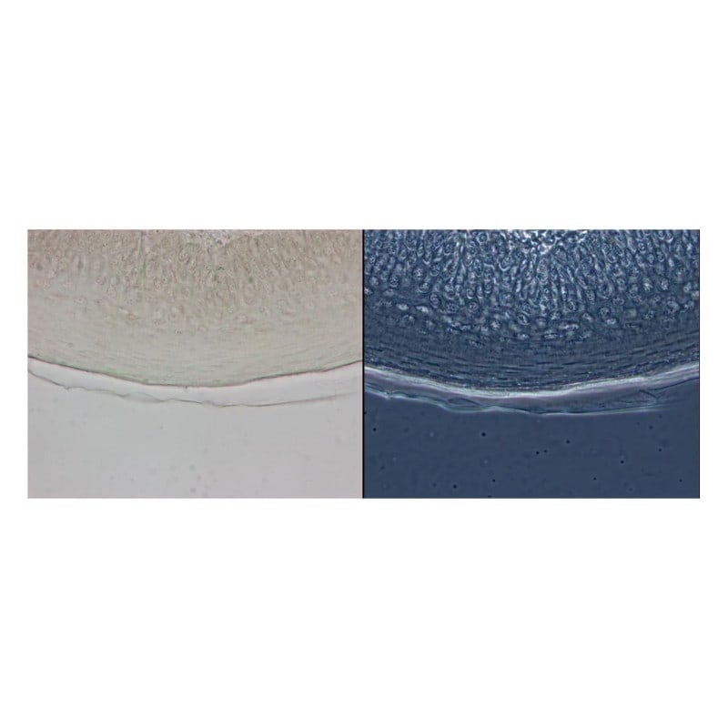 Zeiss Primostar 3 Phase Contrast Microscope with Abbe condenser