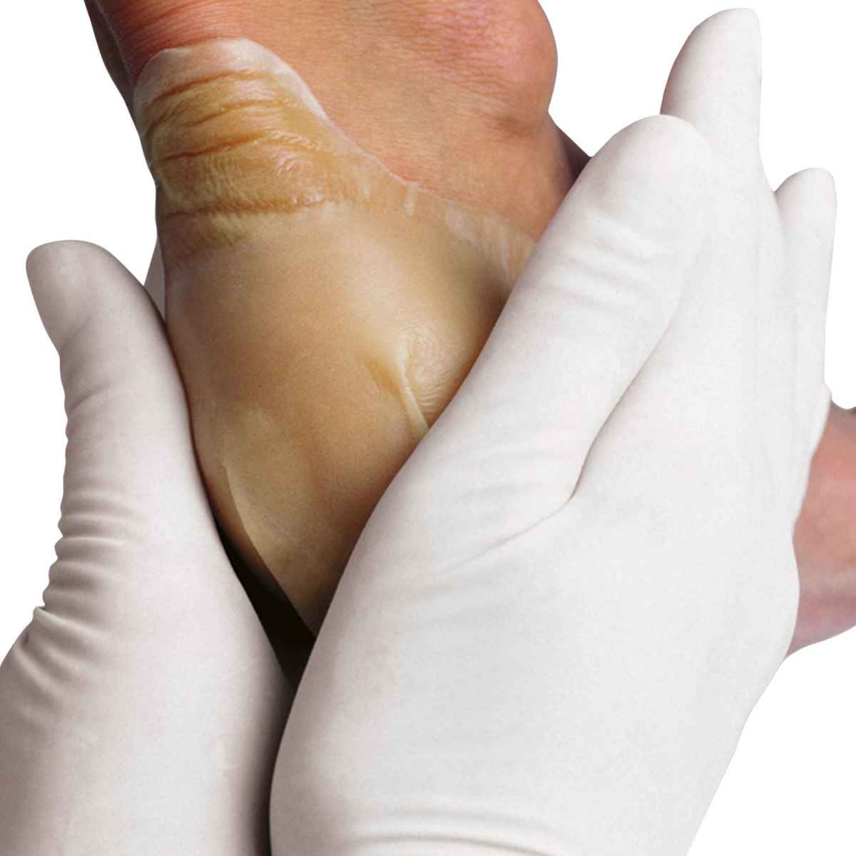 Hydrocoll Hydrocolloid Dressing 15 x 15cm