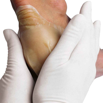 Hydrocoll Hydrocolloid Dressing 15 x 15cm