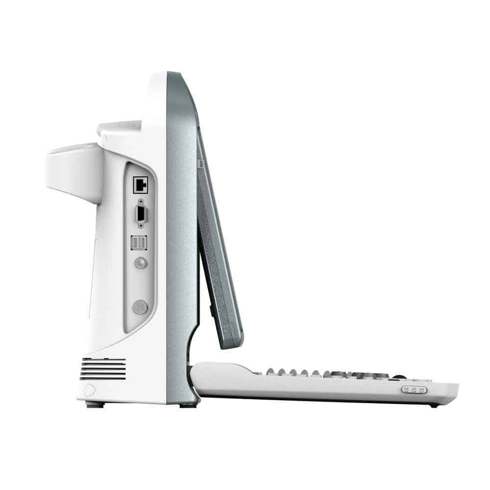 CHISON ECO5 VET Ultrasound Machine with Colour Doppler for Animals