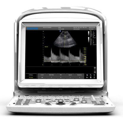 CHISON ECO3 EXPERT Veterinary Ultrasound Machine