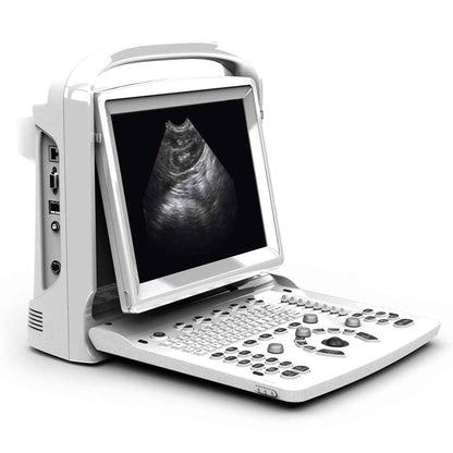 CHISON ECO3 EXPERT Veterinary Ultrasound Machine