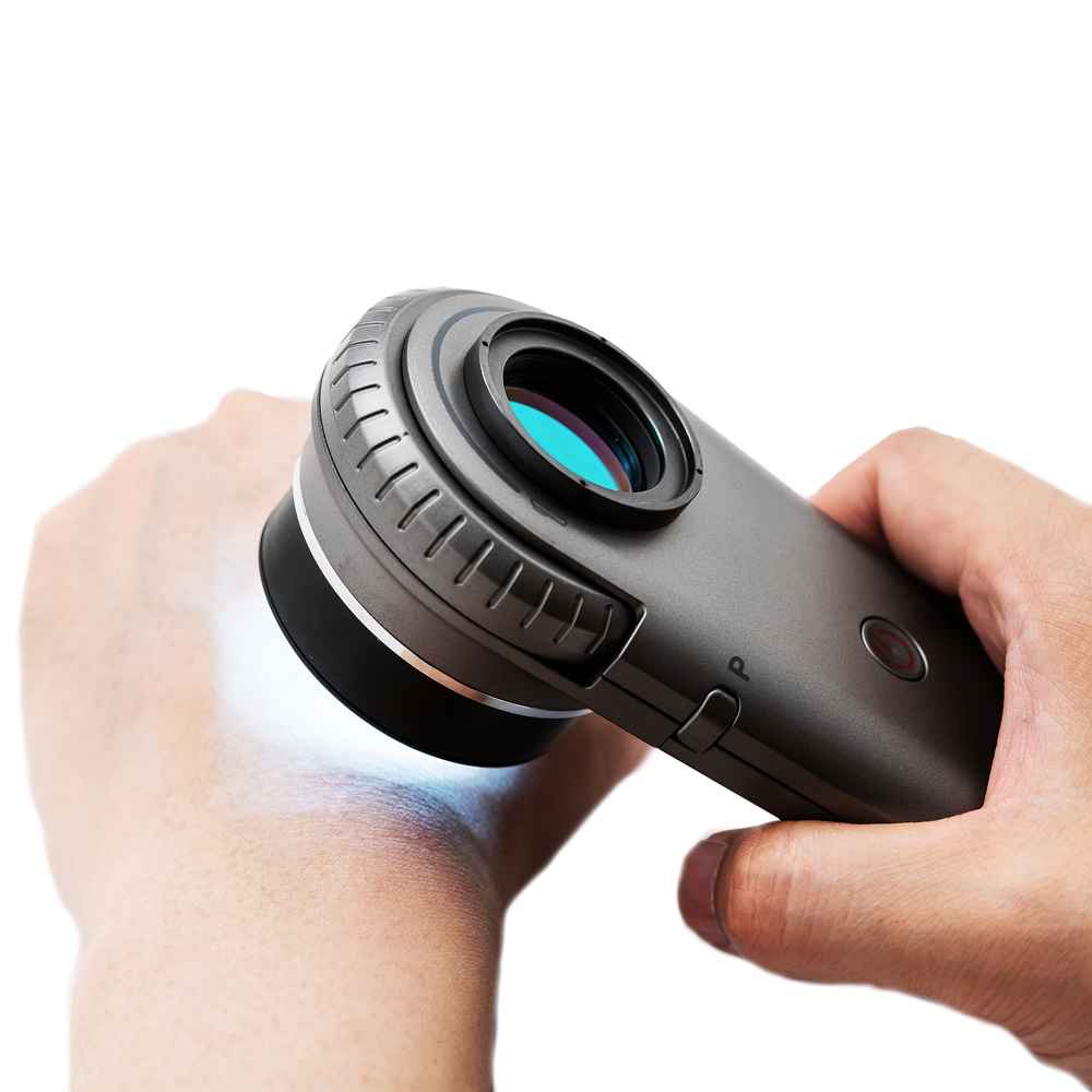 Illuco IDS-1100 Dermatoscope