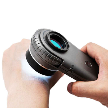 Illuco IDS-1100 Dermatoscope