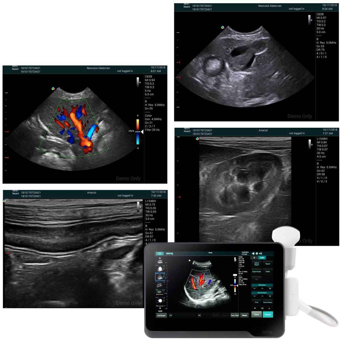 T3300v Ultrasound System with linear probe