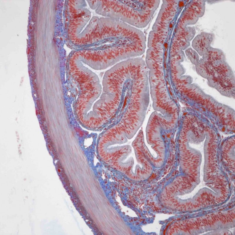 Zeiss Primostar 3 Full-Köhler