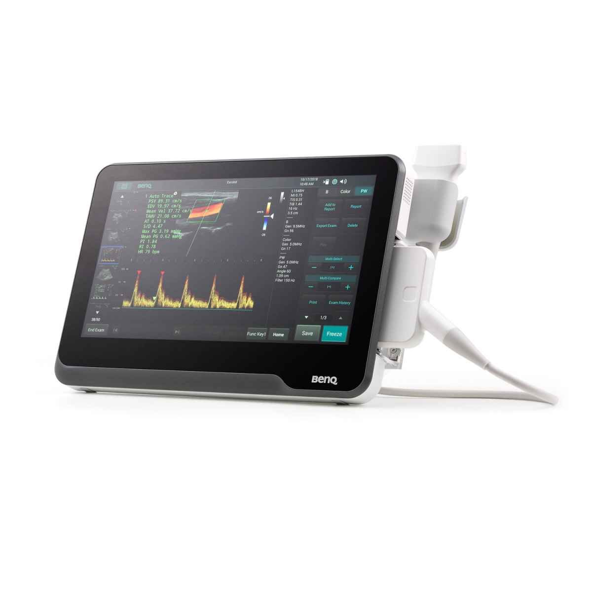 T3300v Ultrasound System with convex probe