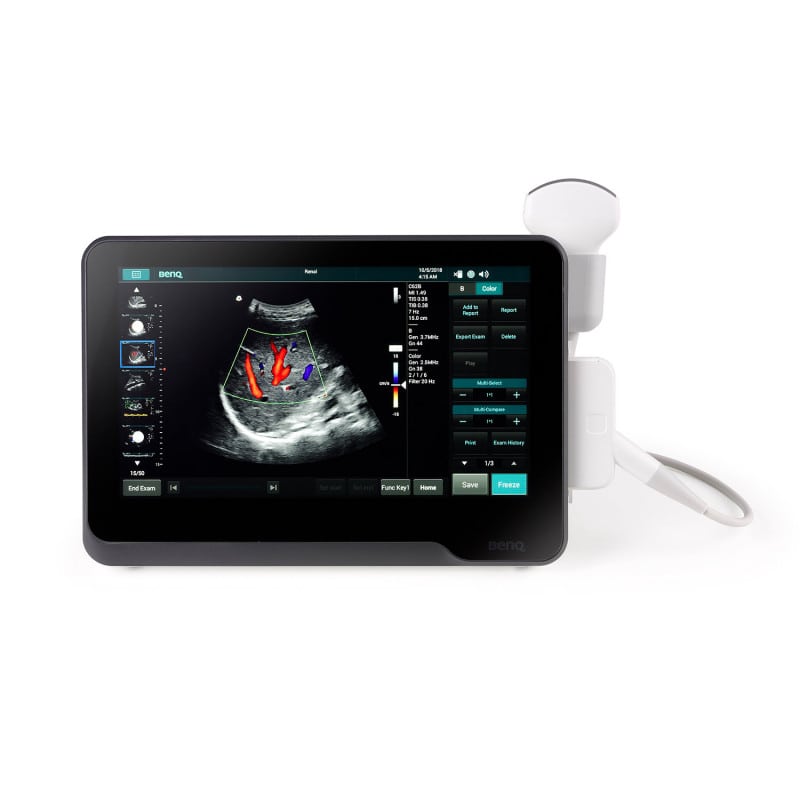 T3300 Ultrasound System