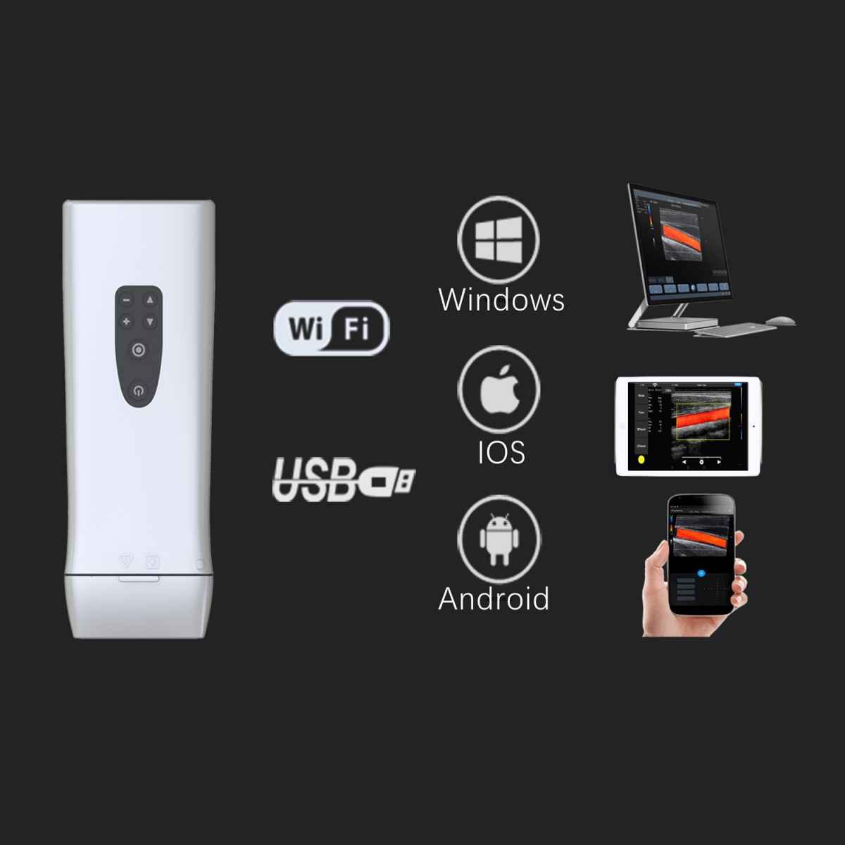 Youkey D8 Wireless Flex Vet Ultrasound System Black/White | Linear Transducer (L11-4Ks)