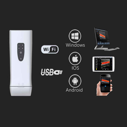 Youkey D8 Wireless Flex Vet Ultrasound System Black/White | Linear Transducer (L11-4Ks)