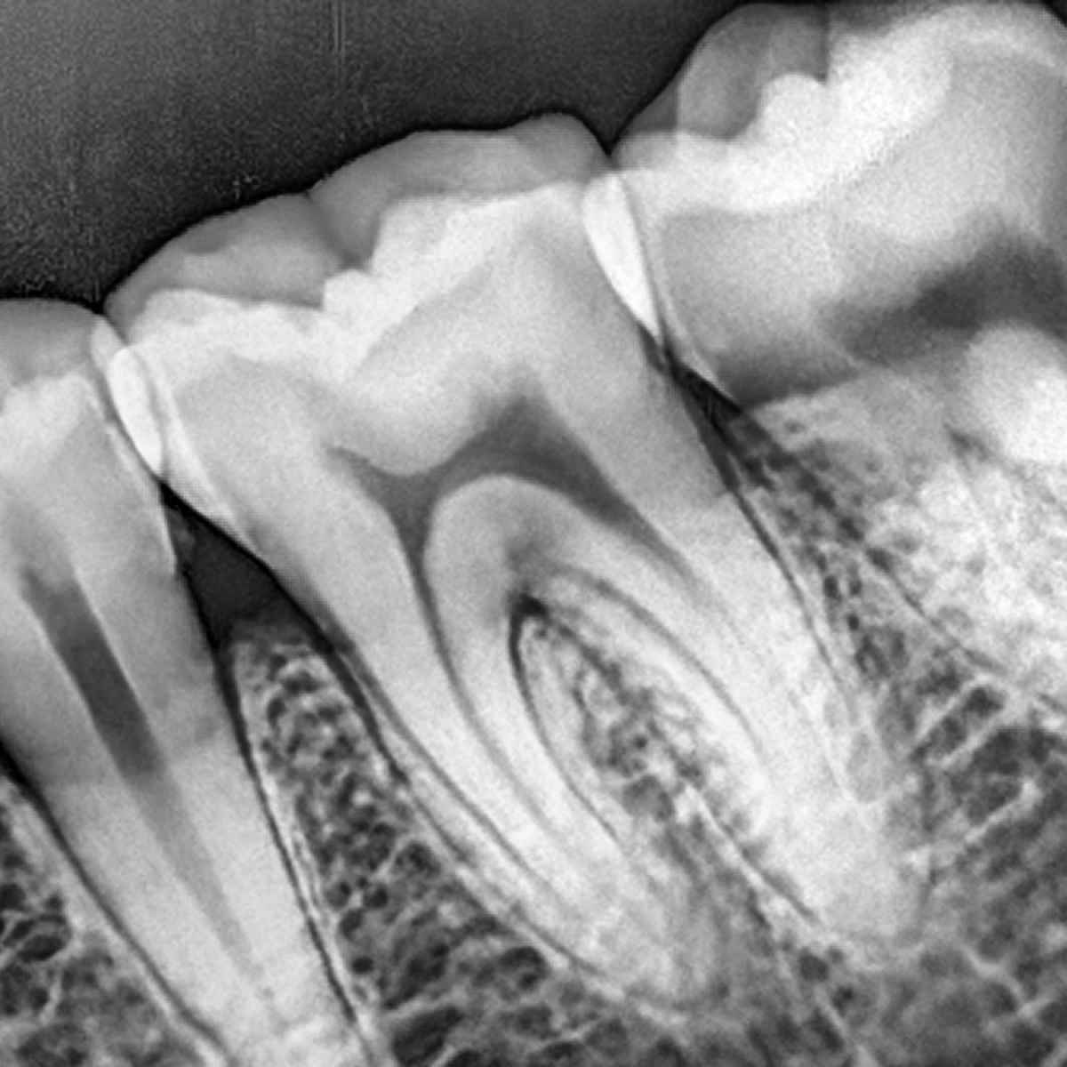Dental X-Ray Unit TT-32DX