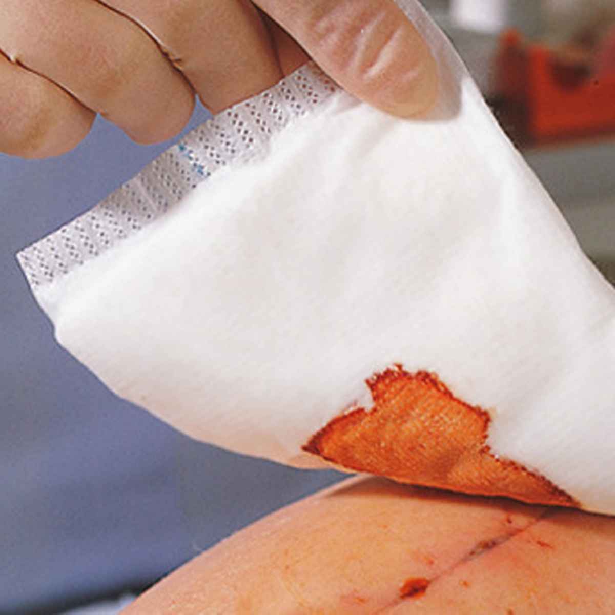 Zetuvit Non-Sterile Absorbent Compresses 10 x 20 cm