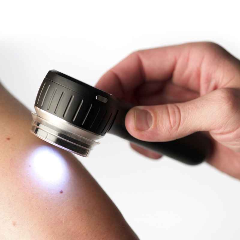 3Gen DermLite DL4 Dermatoscope